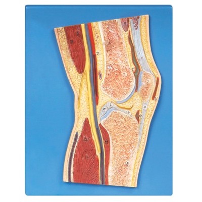 KAY/A11206膝关节剖面模型